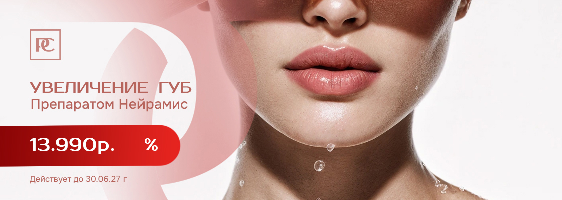 Увеличение губ препаратом Neuramis в Perfect Clinic, Санкт-Петербург
